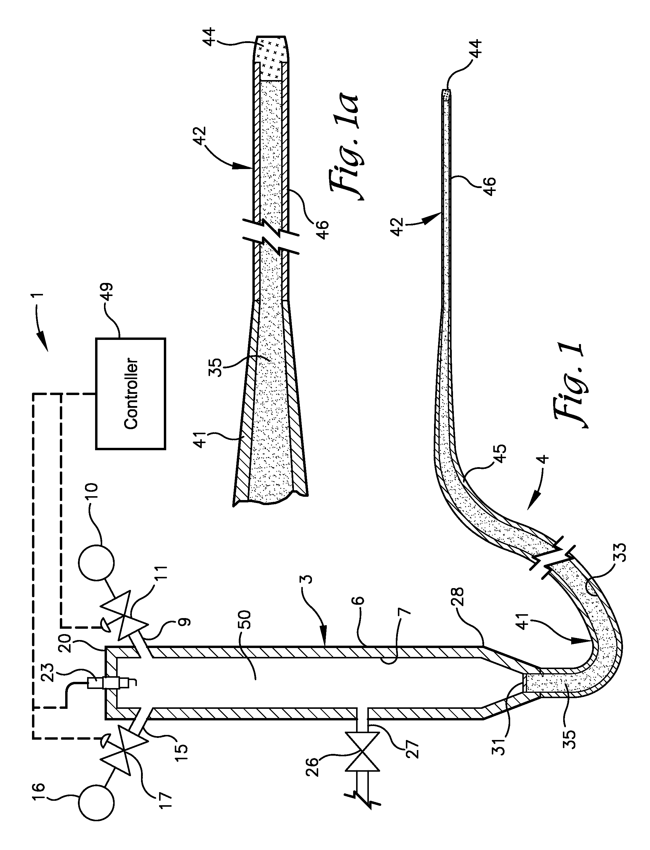Stereotactic shockwave surgery and drug delivery apparatus