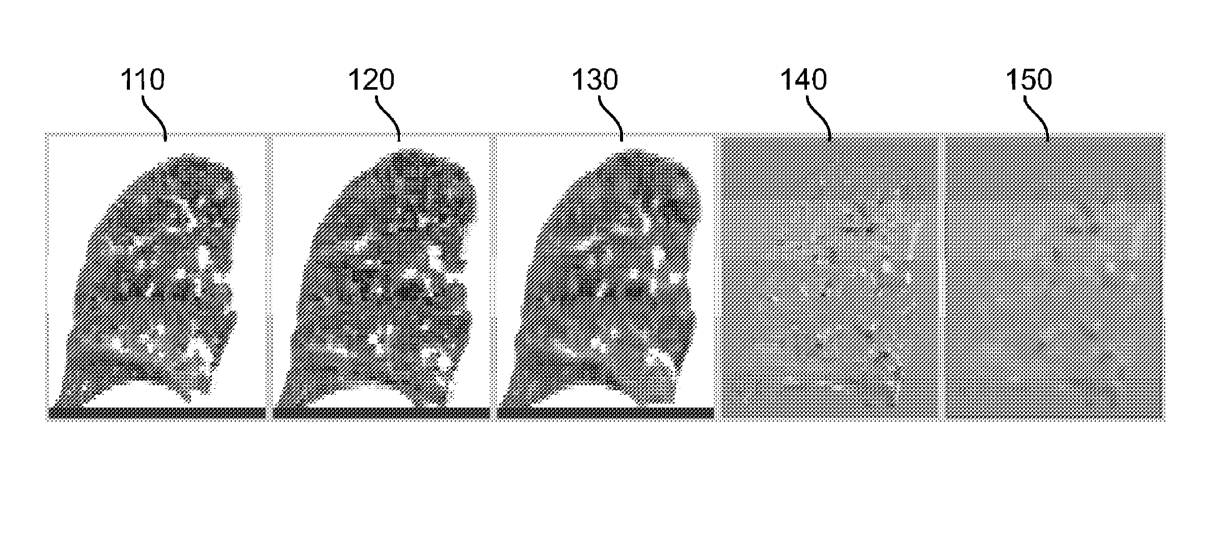 Method and system for using computed tomography to test pulmonary function