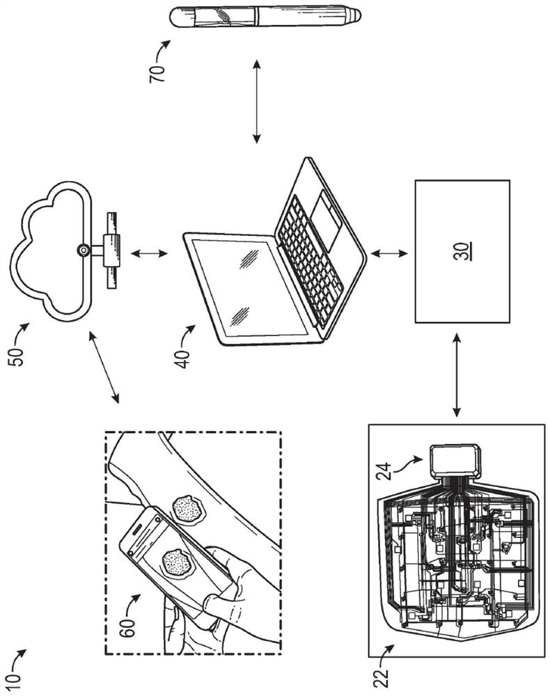 Sensor sheet with digital distributed data acquisition for wound monitoring and treatment