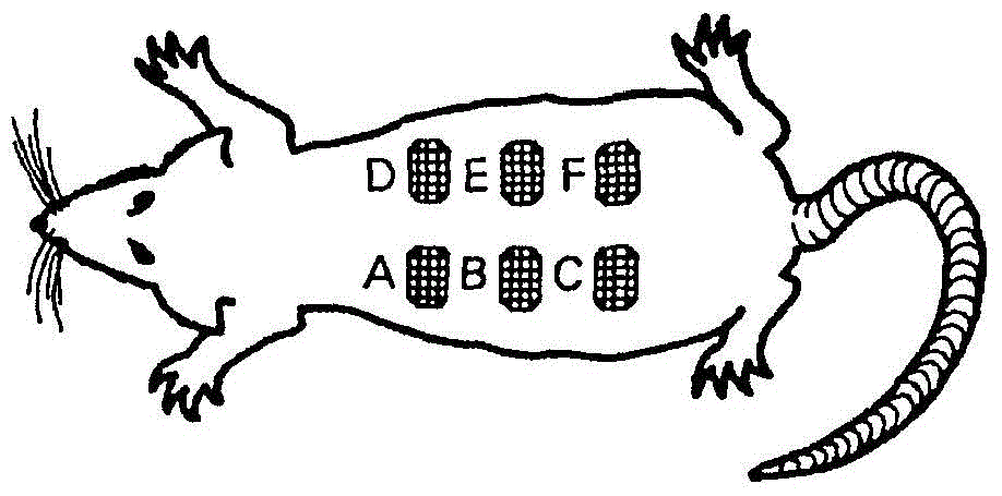 Use of a topical composition containing epidermal growth factor (EGF) for diabetic foot amputation prevention