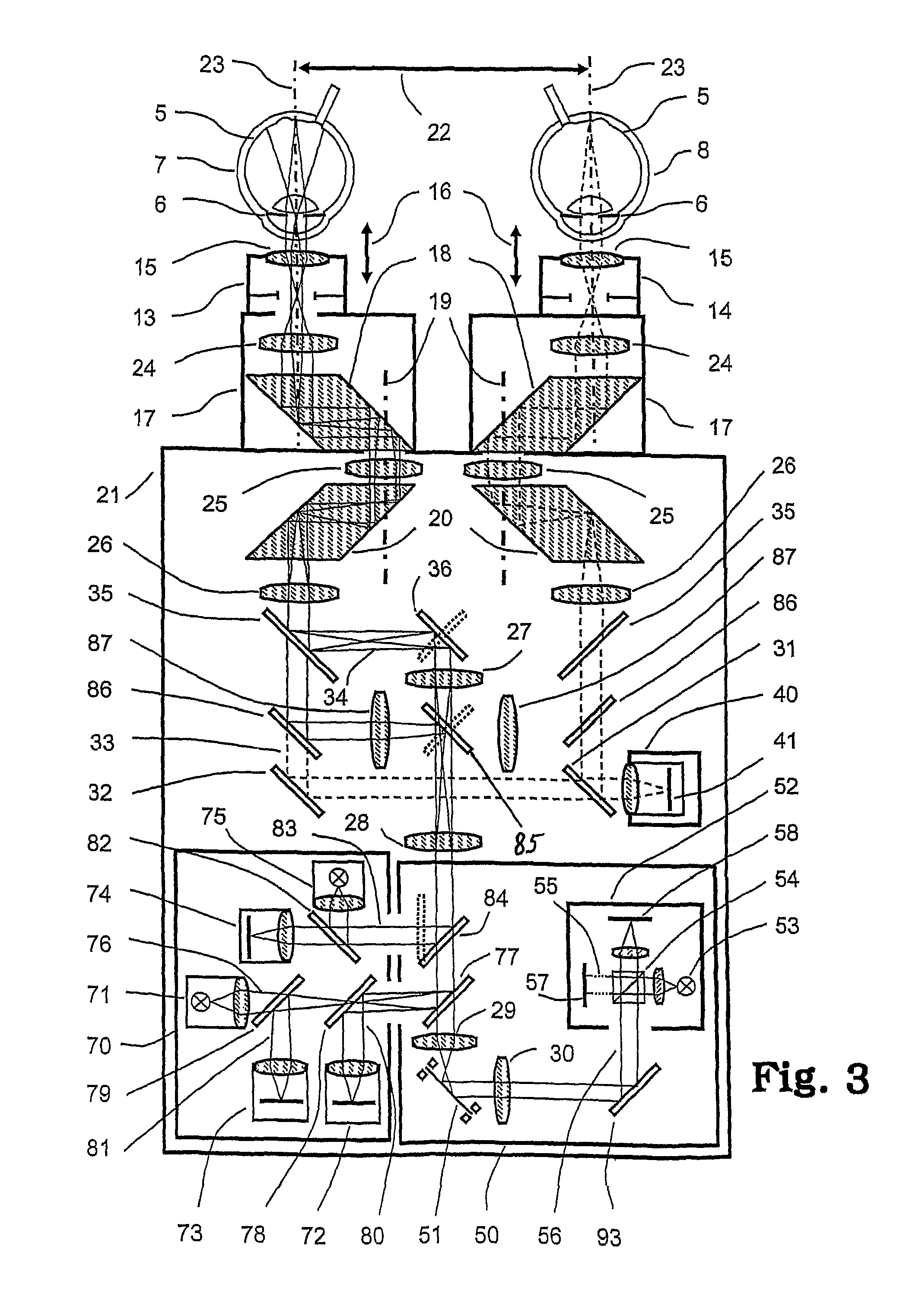 Ophthalmologic apparatus for imaging an eye by optical coherence tomography