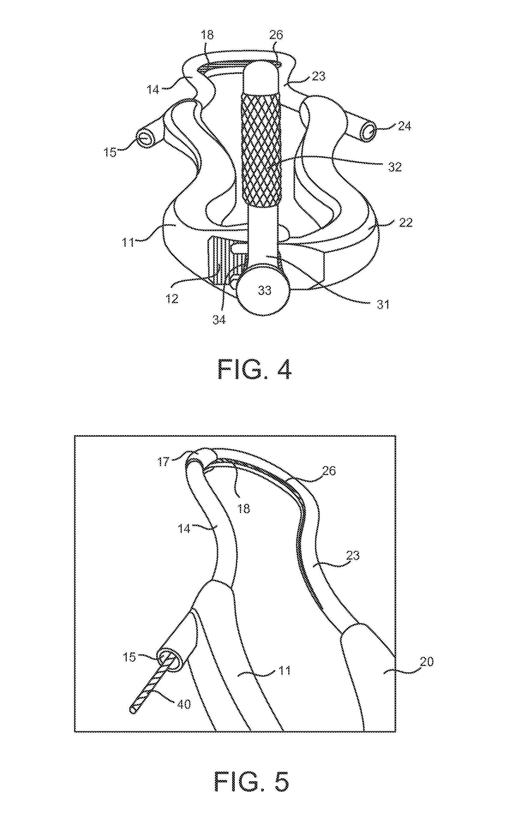 Minimally invasive device for surgical operations