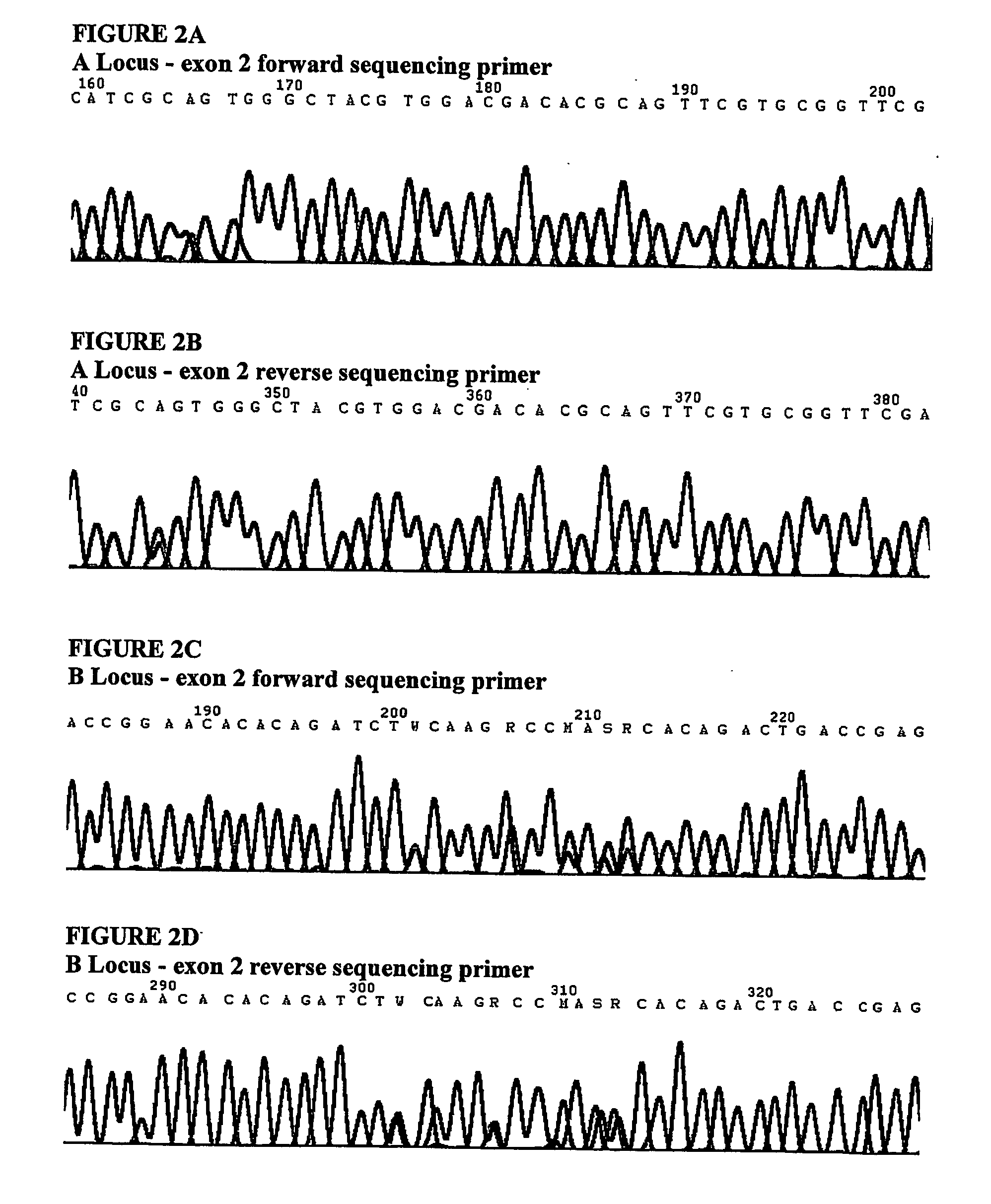 Primers, methods and kits for amplifying or detecting human leukocyte antigen alleles