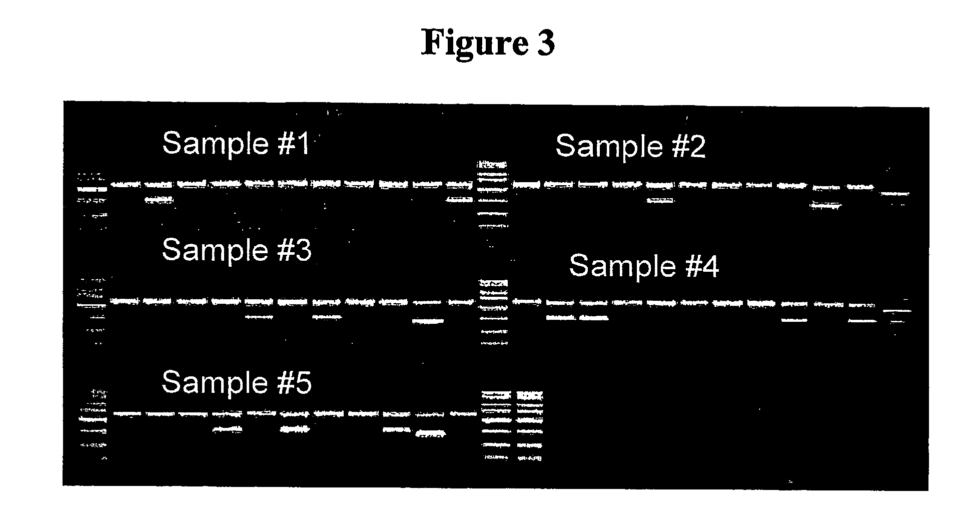 Primers, methods and kits for amplifying or detecting human leukocyte antigen alleles