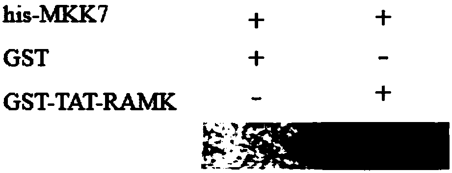 Targeted anti-cancer polypeptide for inhibiting signal transmission of MKK7-JNK pathway and application of polypeptide