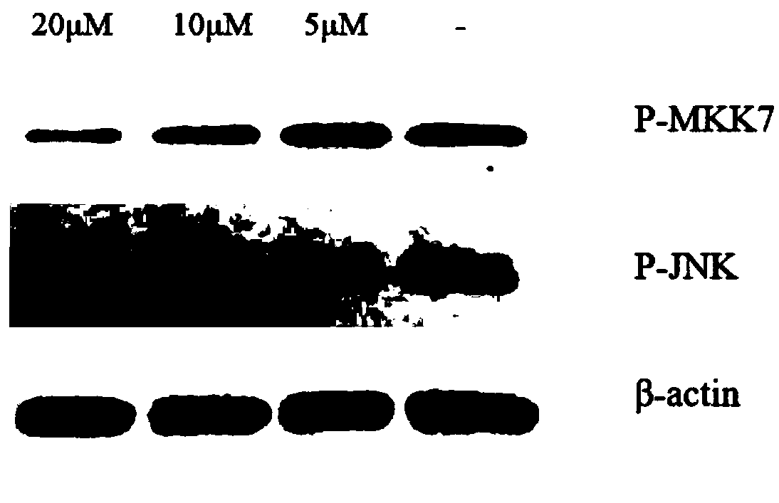 Targeted anti-cancer polypeptide for inhibiting signal transmission of MKK7-JNK pathway and application of polypeptide