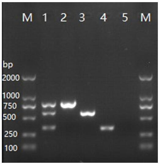 A detection primer set, detection kit and multiple PCR detection method for Streptococcus agalactiae