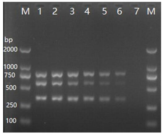 A detection primer set, detection kit and multiple PCR detection method for Streptococcus agalactiae