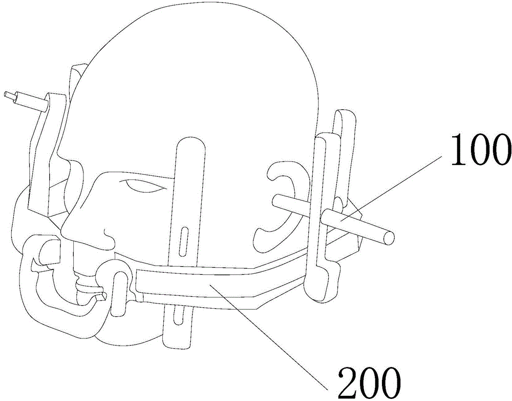 Individualized stereotactic head ring placing support