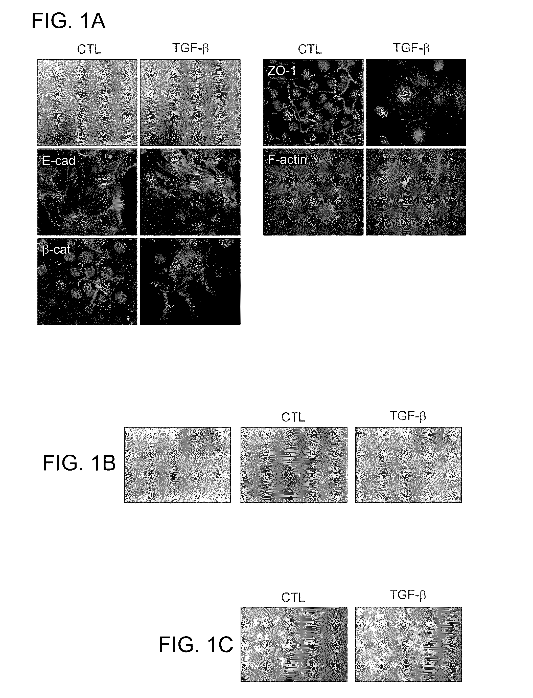 Methods and compositions for modulating tumor cell activity
