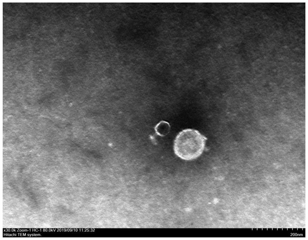 Piglet diarrhea coliphage and application thereof