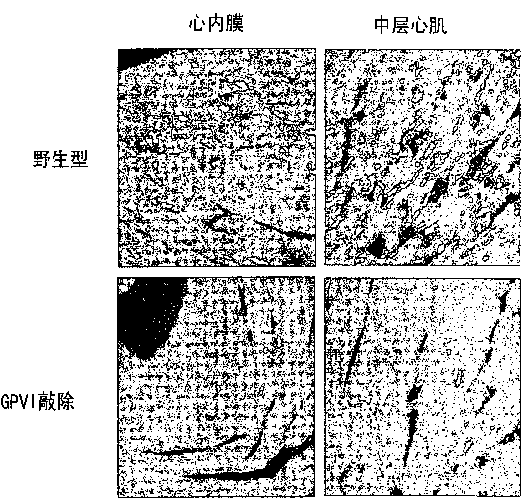 Uses of a glycoprotein VI (GPVI) inhibitor