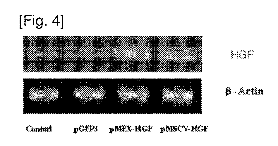 Mesenchymal stem cells which express human hepatic growth factor,manufacturing method thereof, and use thereof as therapeutic agent for liver diseases