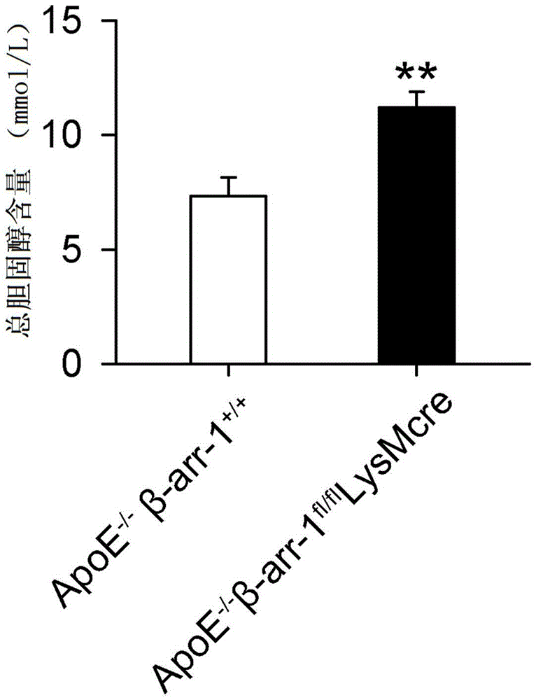 Application of macrophage beta-profilin-1 to preparation of drug for preventing or treating atherosclerosis