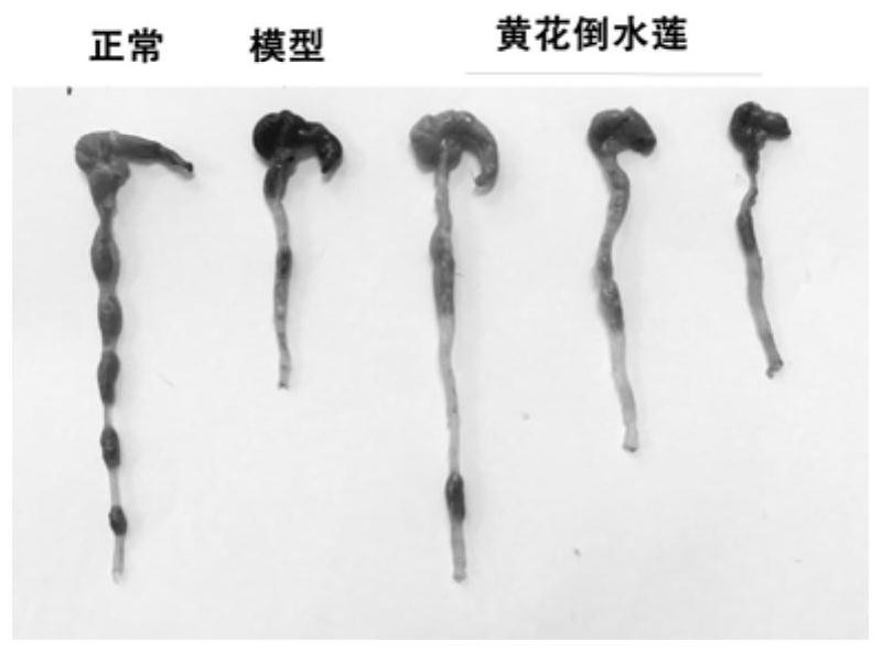 Application of polygala fallax hemsl extract to preparation of medicine for treating ulcerative colitis