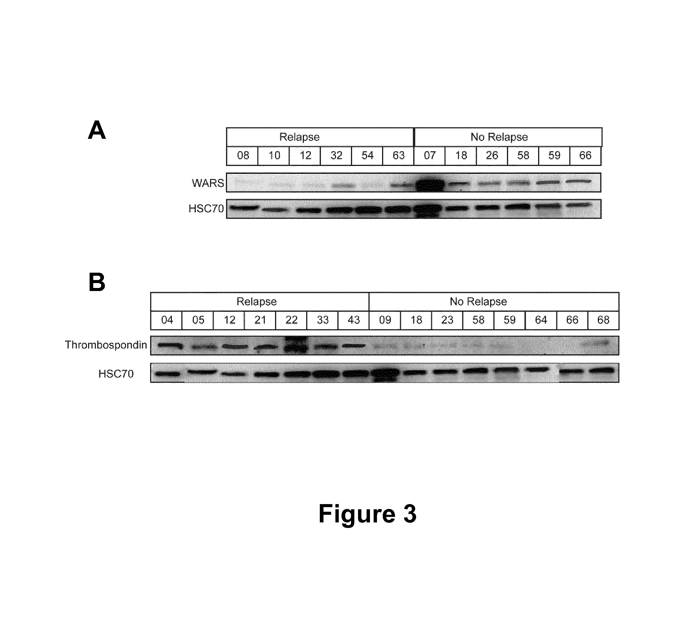 Method for In Vitro Diagnosing and Prognosing of Triple Negative Breast Cancer Recurrence
