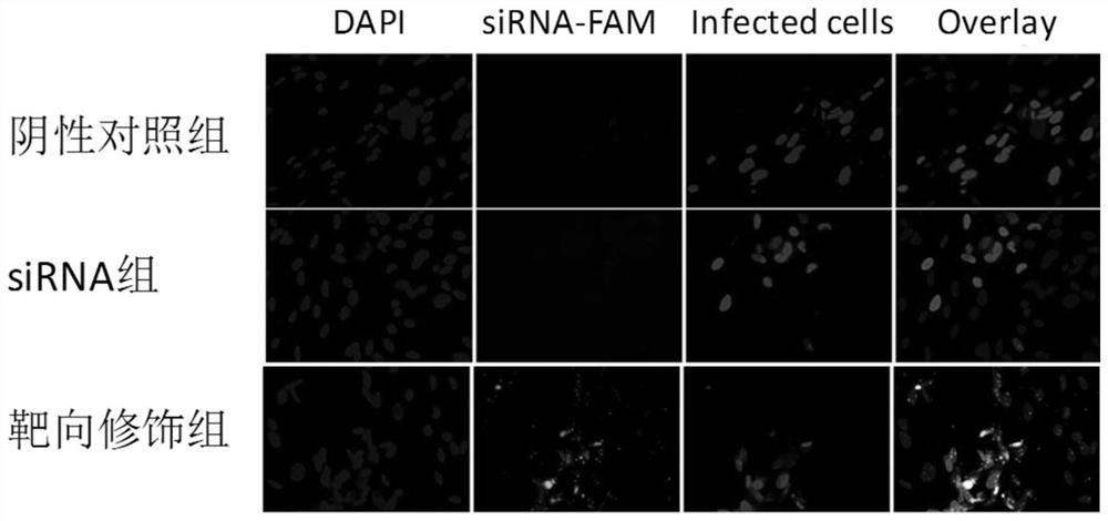 Small nucleic acid for inhibiting human cytomegalovirus infection as well as preparation and application thereof