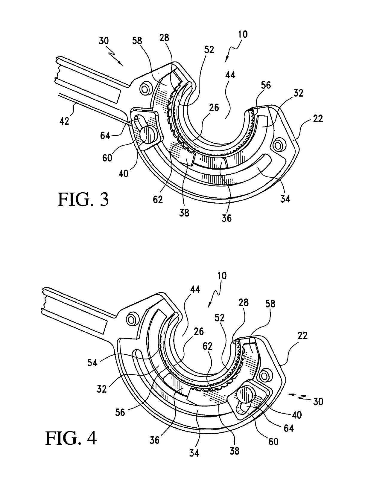 Method for suture lacing