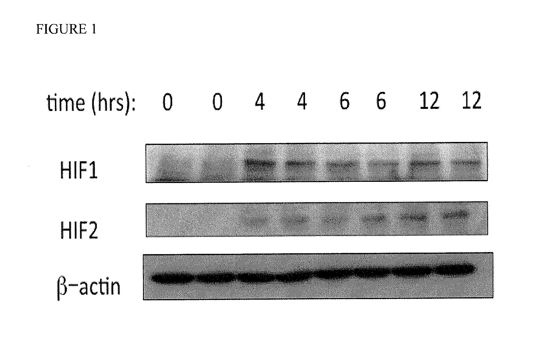 Use of prolyl hydroxylase inhibitors as a radioprotective drug for the lower gastrointestinal tract