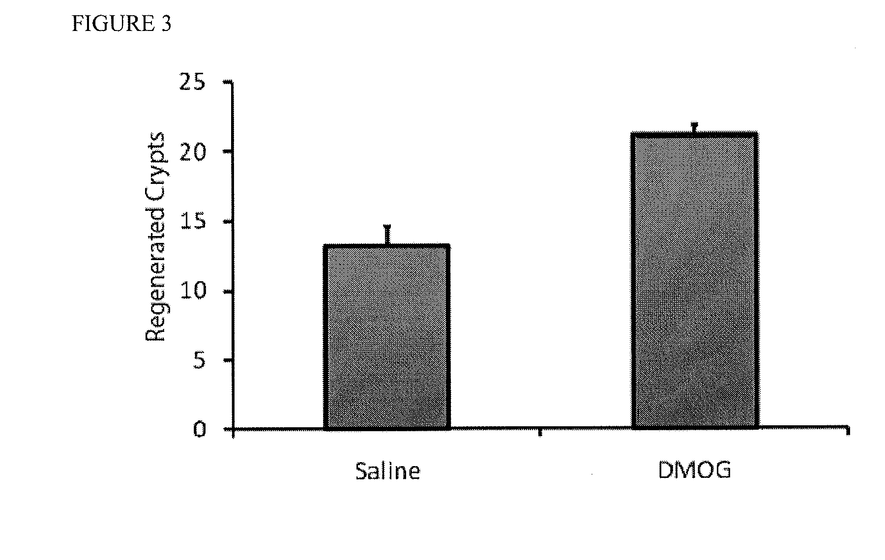 Use of prolyl hydroxylase inhibitors as a radioprotective drug for the lower gastrointestinal tract