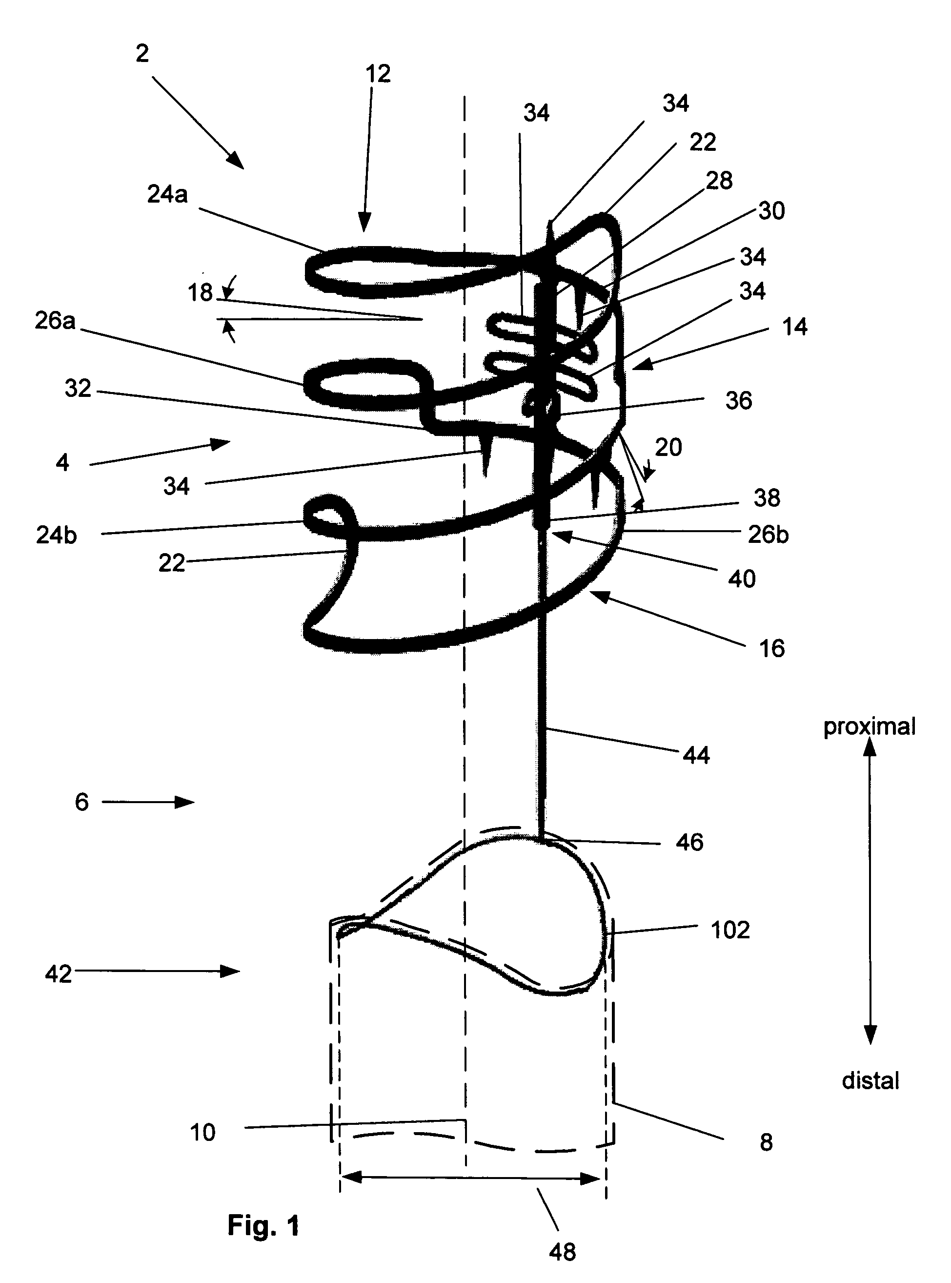 Vascular fixation device and method