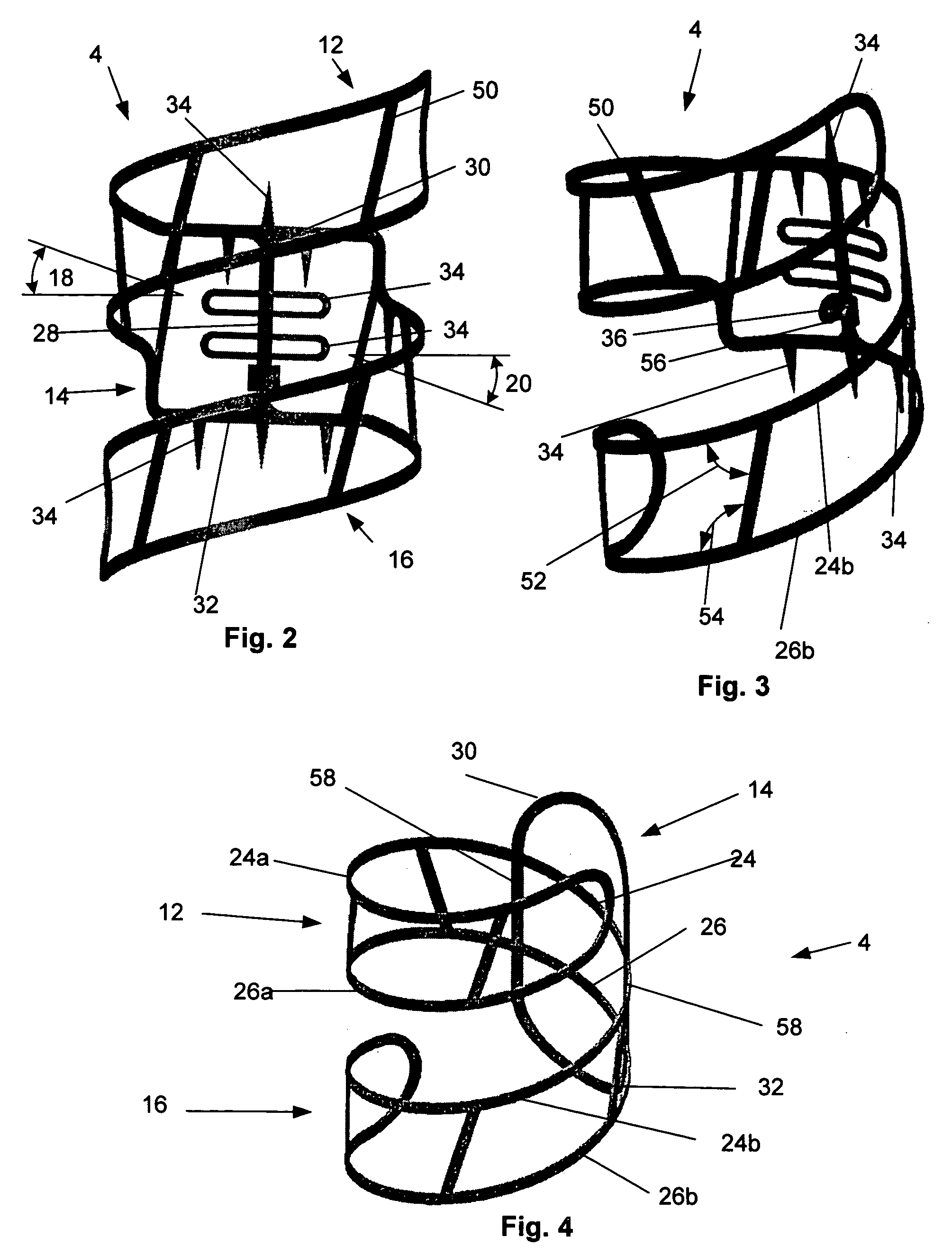 Vascular fixation device and method