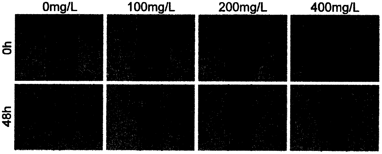 Application of dandelion polysaccharides in preparation of drugs for inhibiting angiogenesis of hepatocellular carcinoma cells