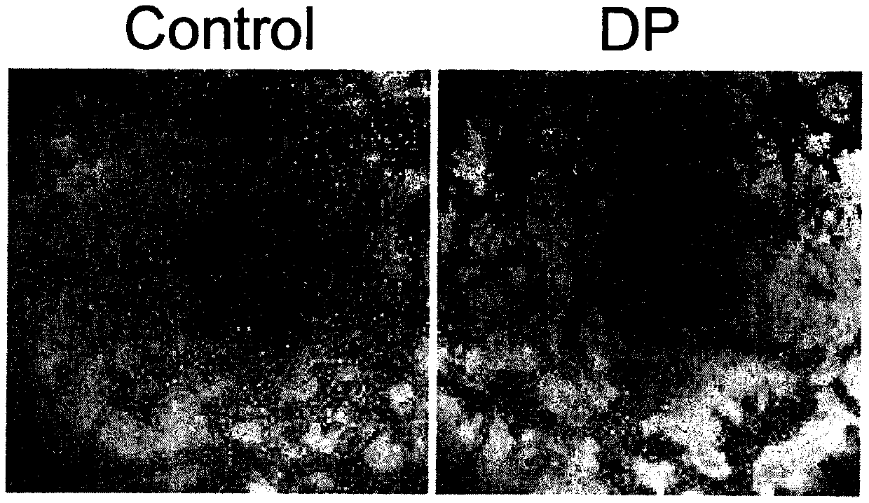 Application of dandelion polysaccharides in preparation of drugs for inhibiting angiogenesis of hepatocellular carcinoma cells