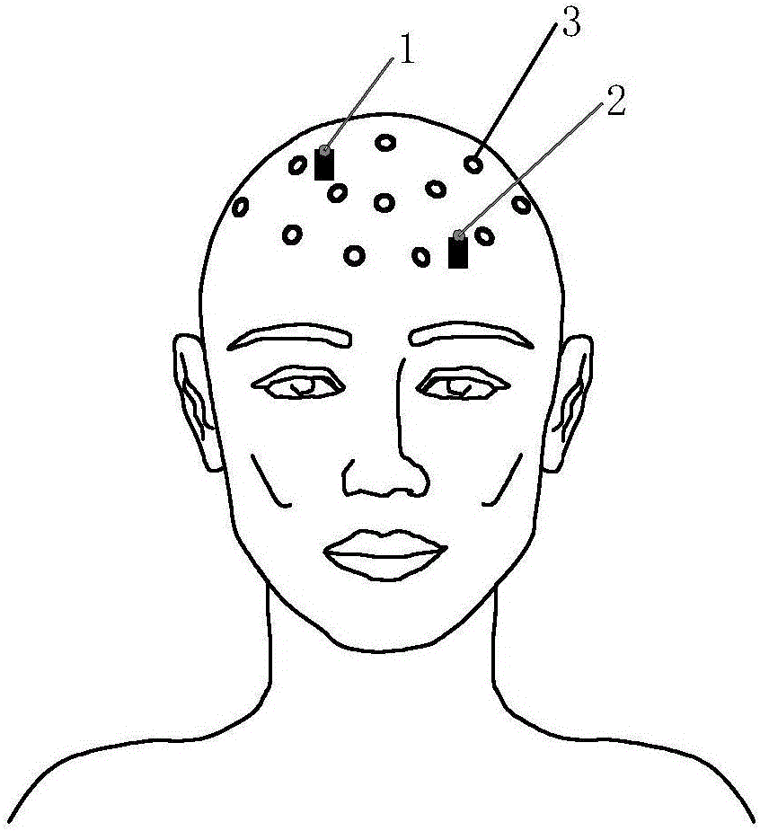 Motor imagery brain-computer interface control method based on noninvasive electrical stimulation