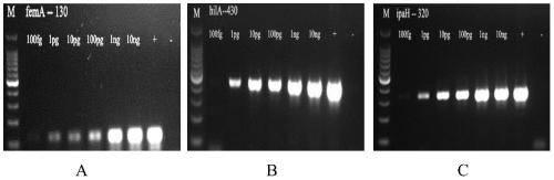 Primer set, kit and detection method for multiplex PCR detection of three types of pathogenic bacteria in food