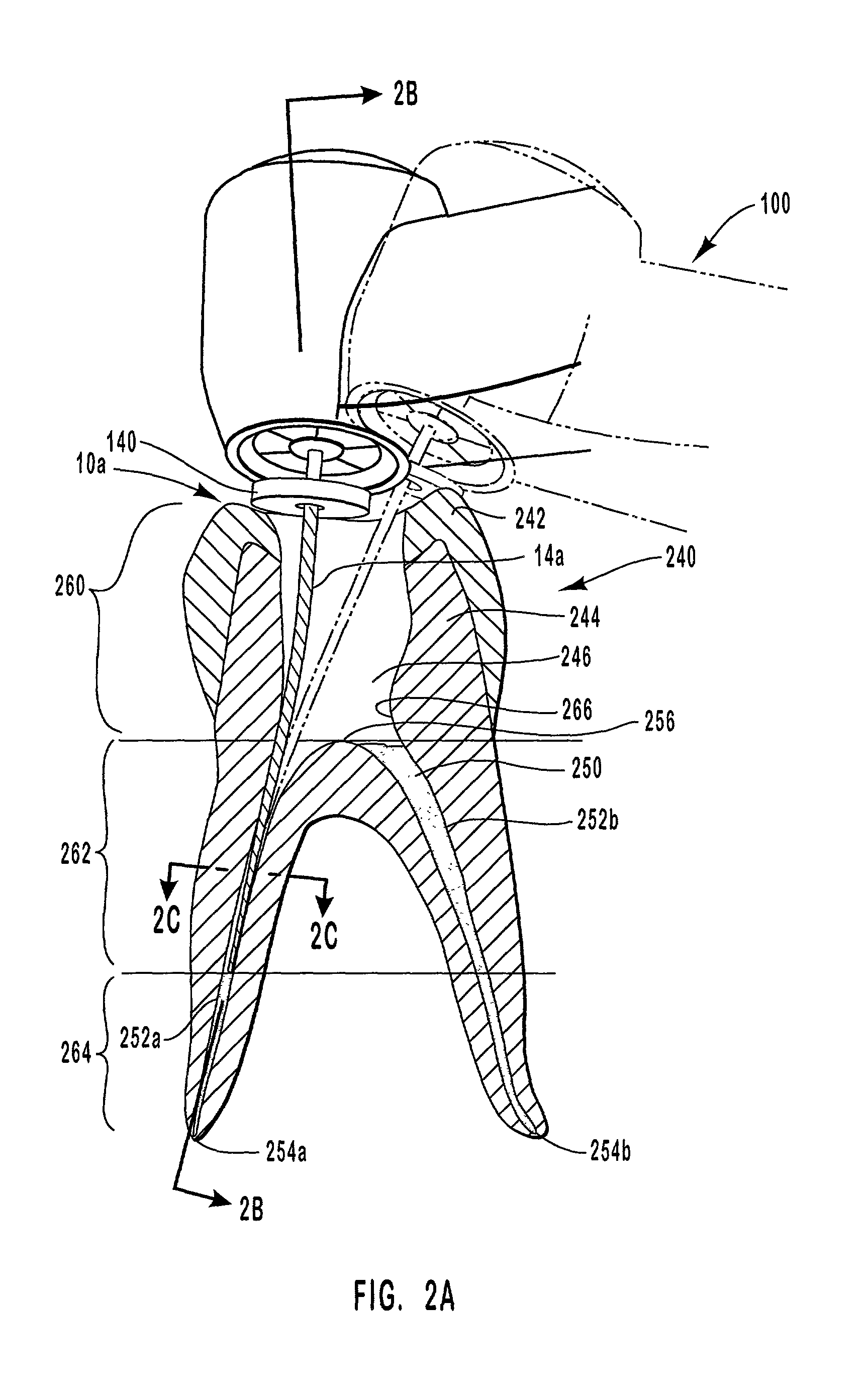 Endodontic systems and methods for preparing apical portions of root canals with a set of files having large tapers