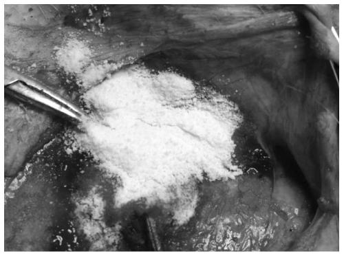 Tissue sealing agent powder and preparation process thereof, and tissue sealing agent