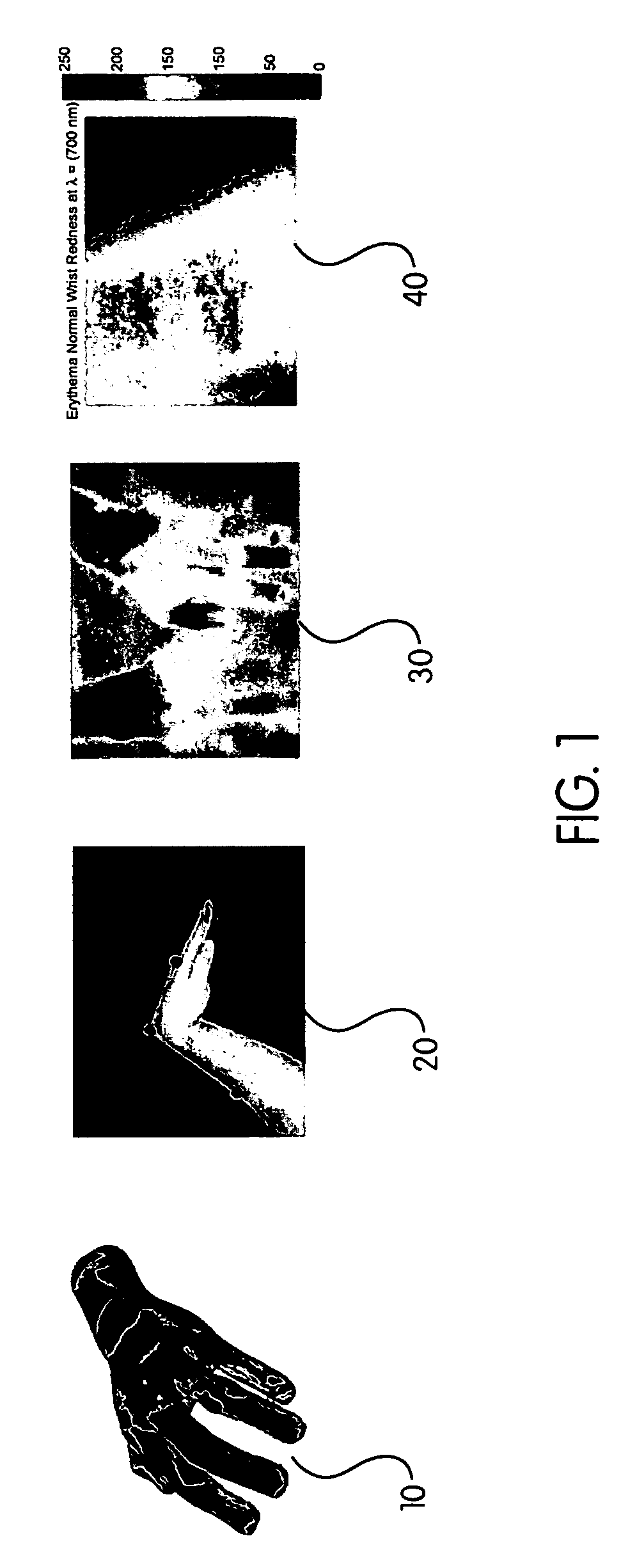 Method of assessing localized shape and temperature of the human body