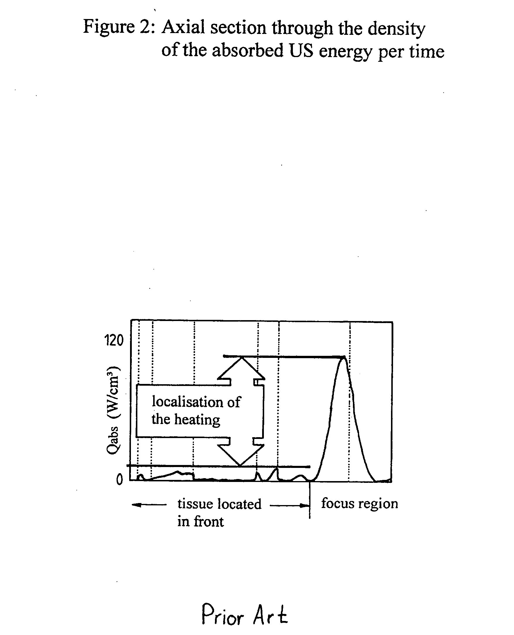 Method for effecting local increases in temperature inside materials, particularly body tissue