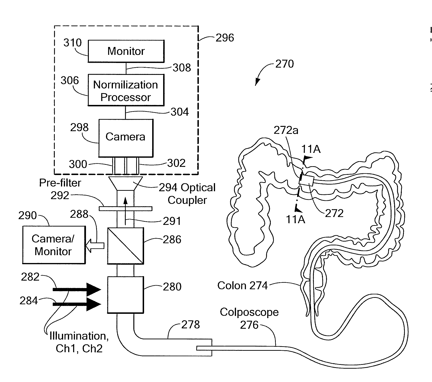 System and Method for Normalized Diffuse Emission Epi-illumination Imaging and Normalized Diffuse Emission Transillumination Imaging