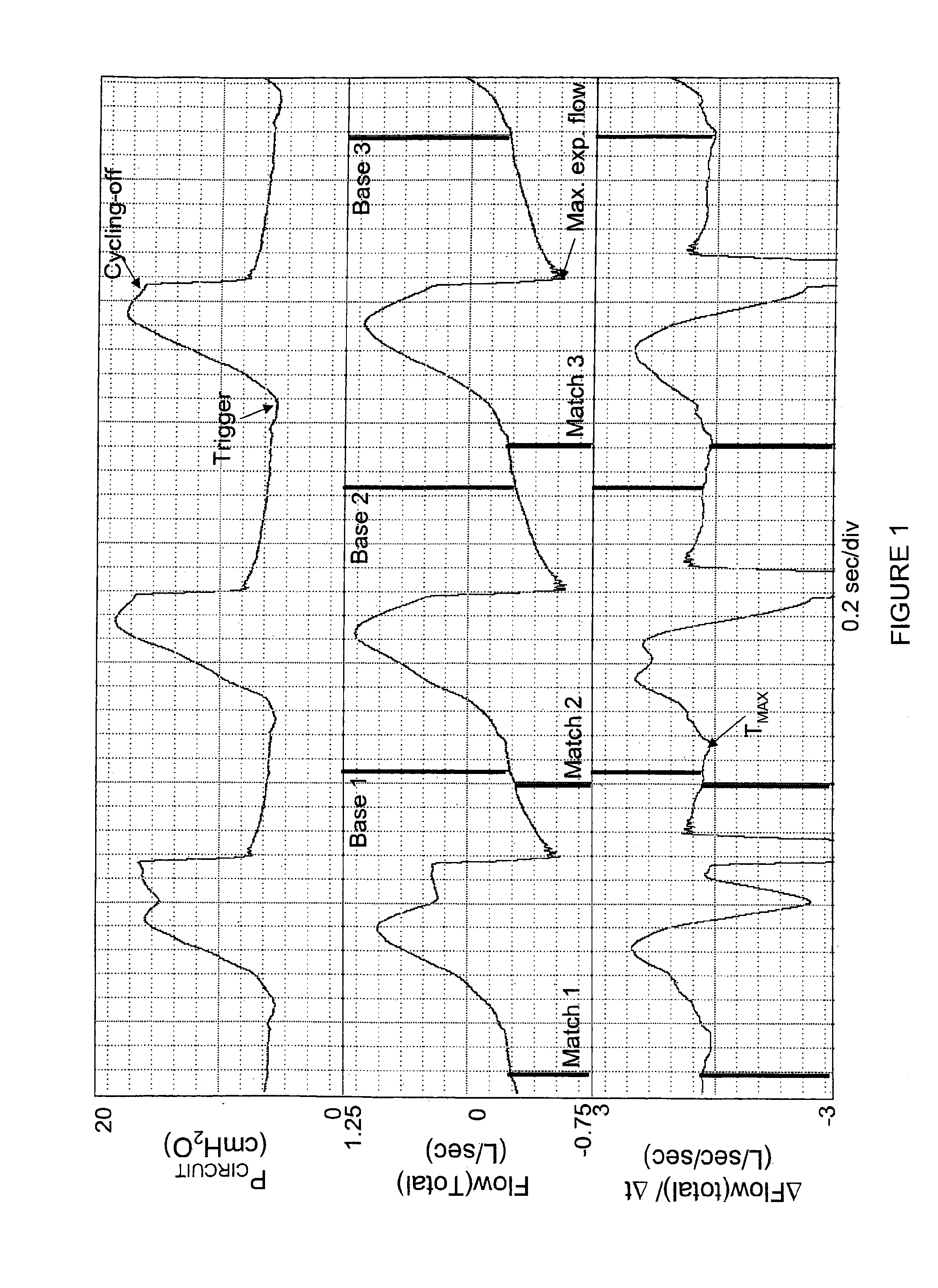 Method for estimating leaks from ventilator circuits