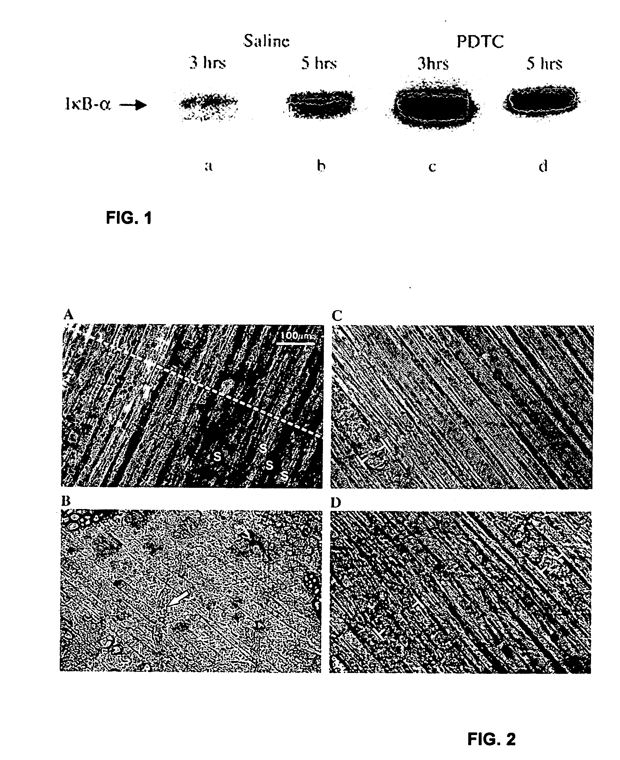 Compositions and methods for the treatment of muscular dystrophy