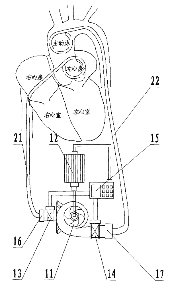 External cardio pump