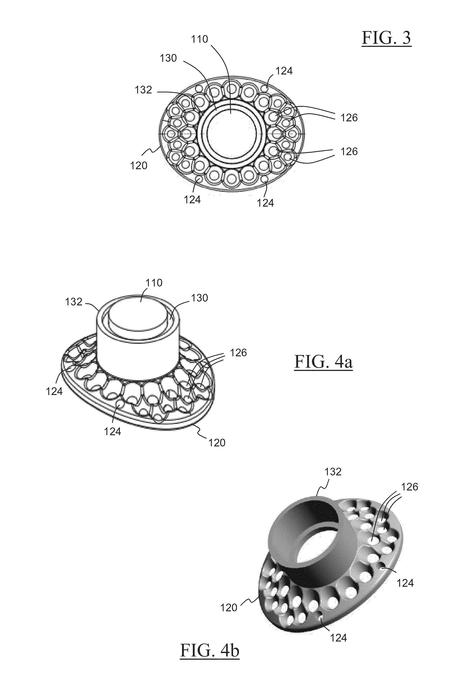 Novel keratoprosthesis, and system and method of corneal repair using same