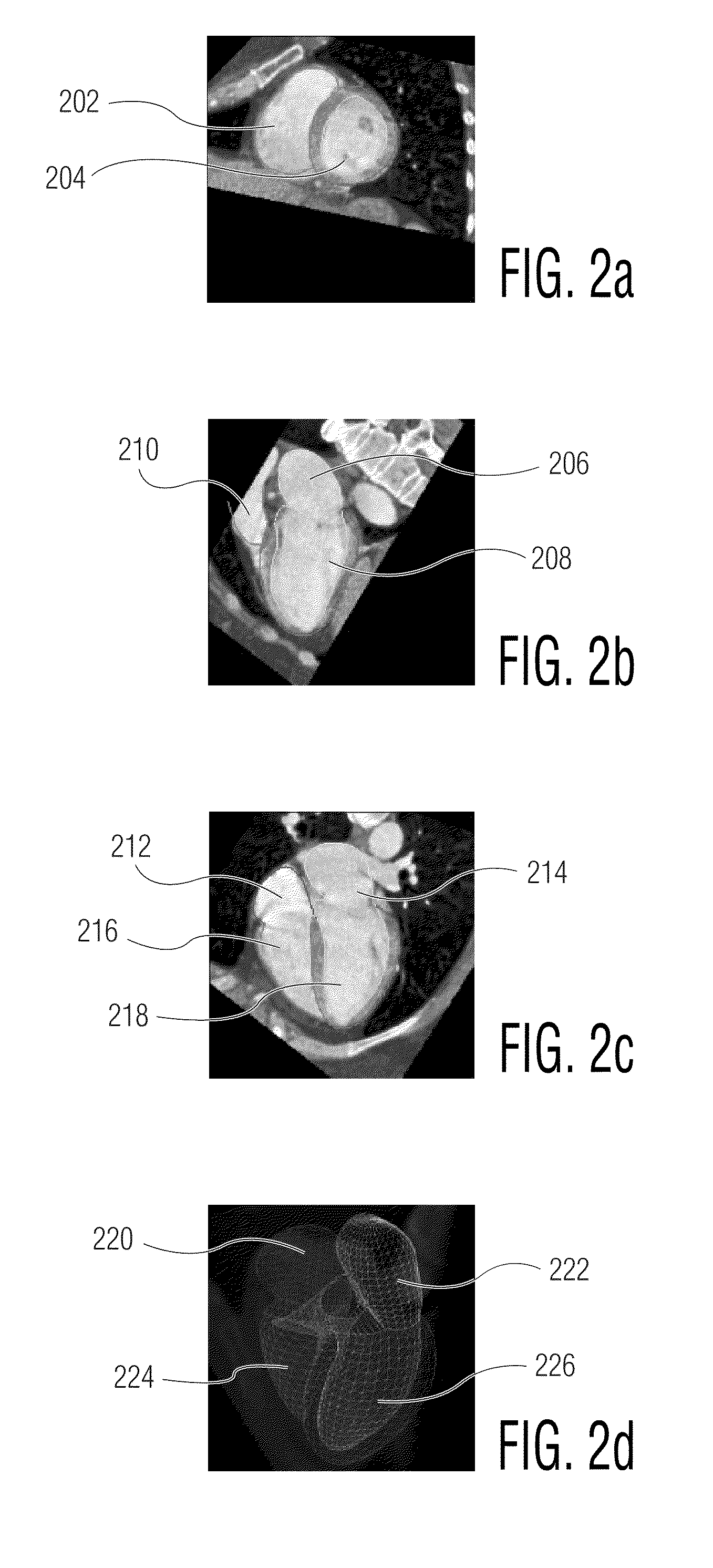 System and method for segmenting chambers of a heart in a three dimensional image