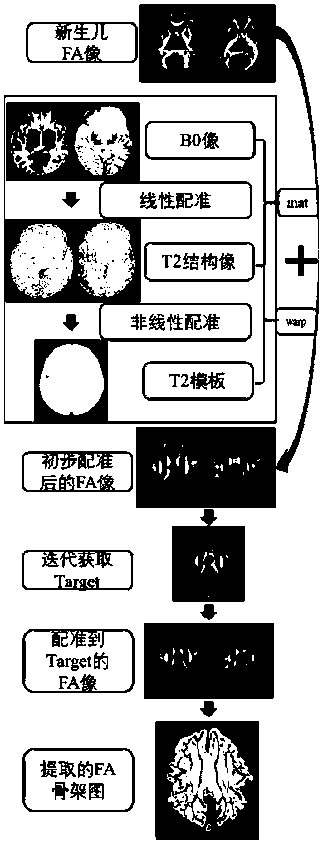 Magnetic resonance diffusion tensor brain image analysis method and system for newborns