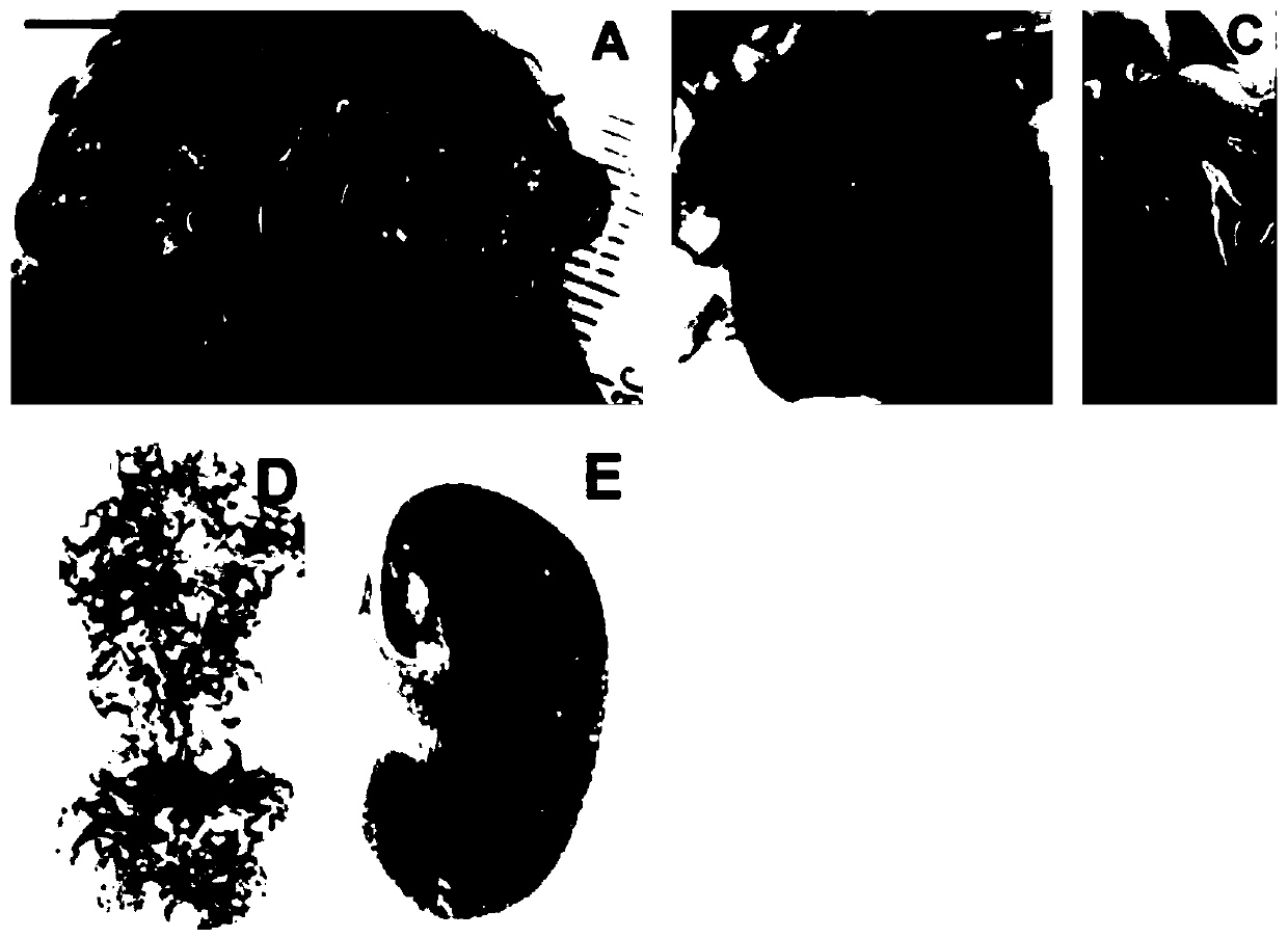 Uses of shh signaling pathway inhibitors