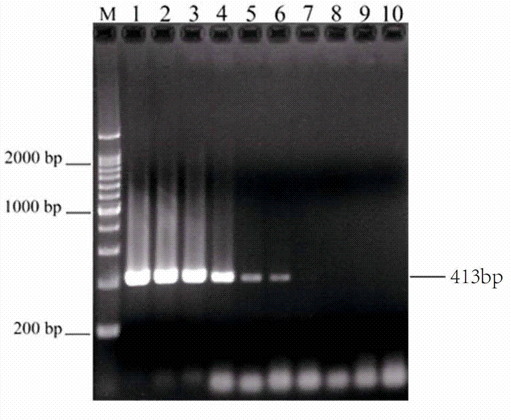 Multiplex PCR detection method for Salmonella typhimurium and its serovars