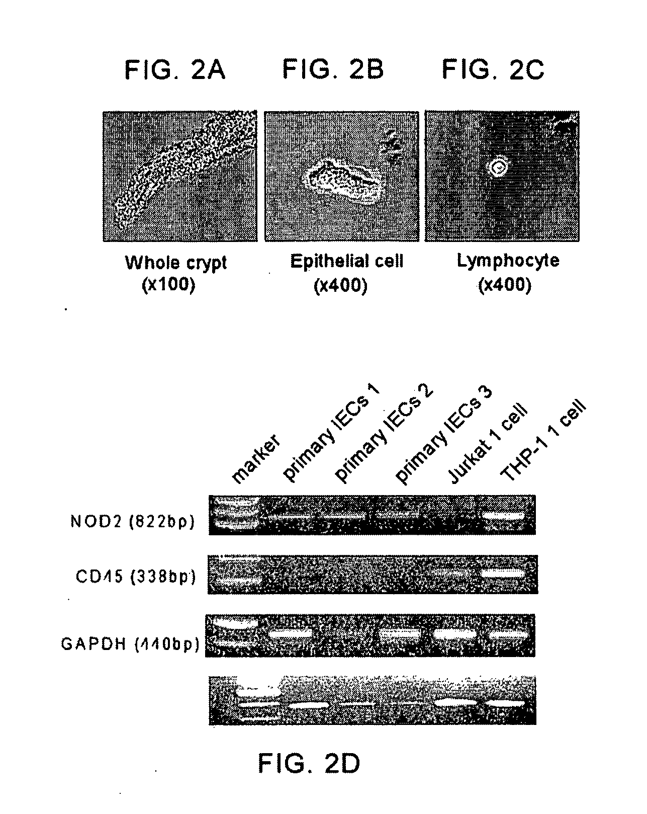 Compositions And Methods Related To An Intestinal Inflammation And Uses Therefor