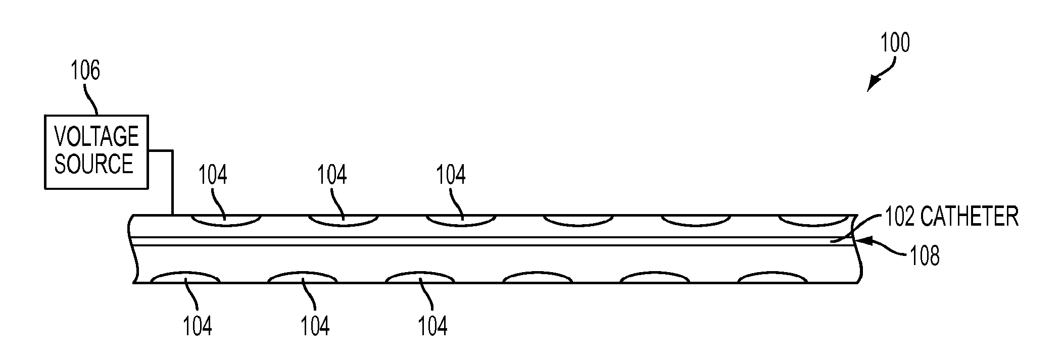 Catheter/Stent System For Activation of Photodynamic Therapy Within The Catheter/Stent System
