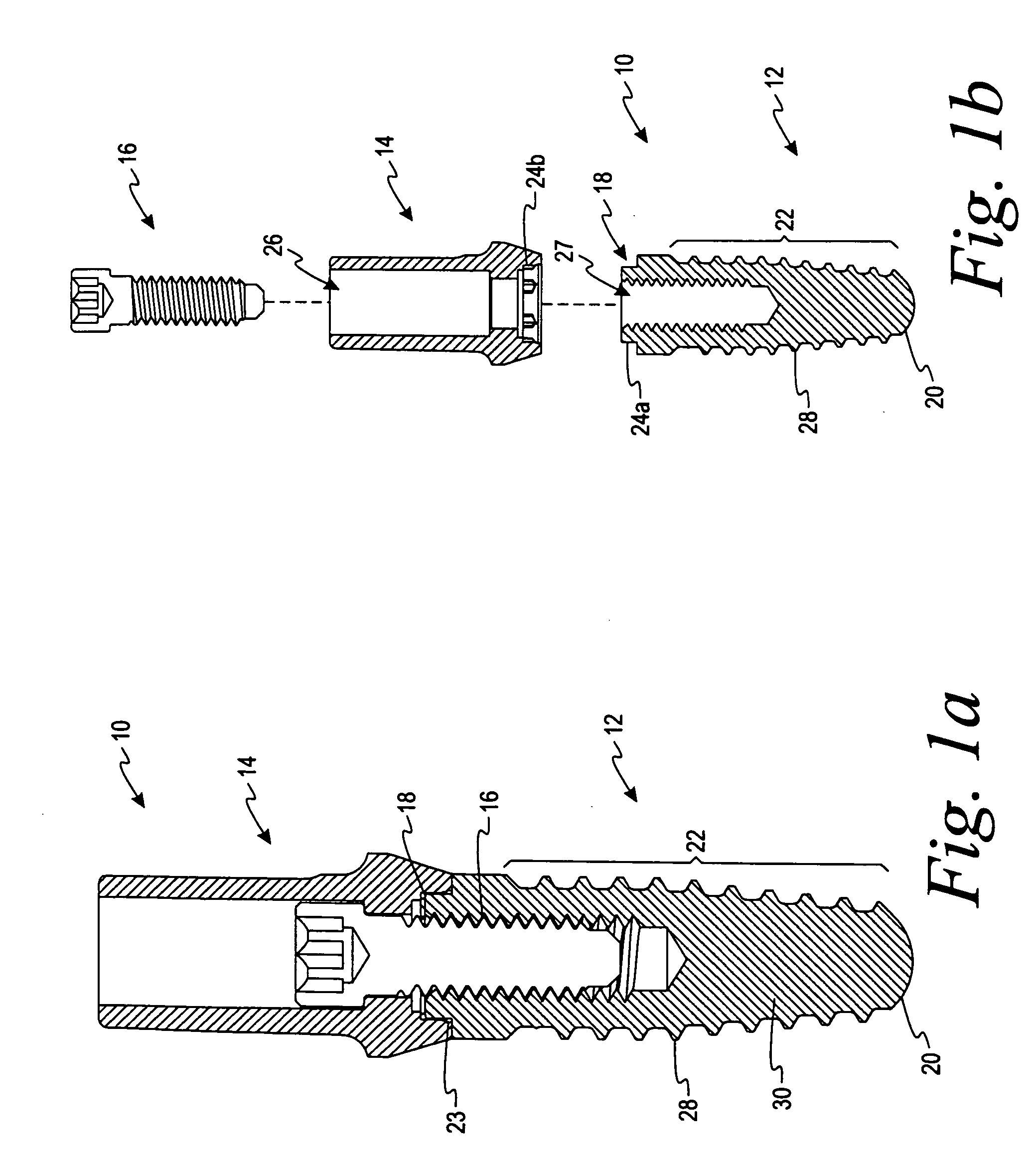 Deposition of silver particles on an implant surface
