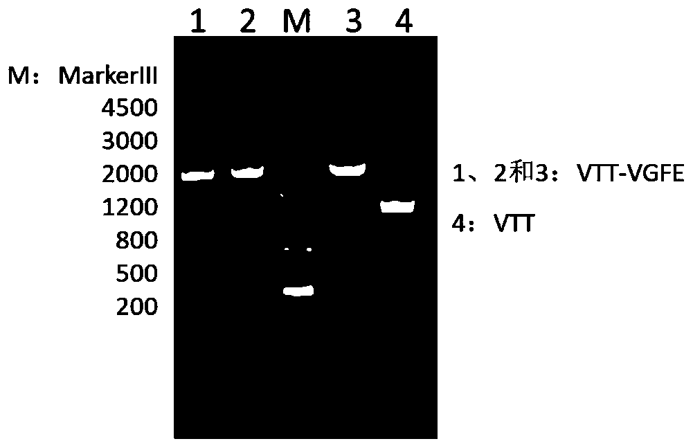 VGF gene removed recombinant Tiantan strain oncolytic vaccinia virus, and preparation and applications thereof