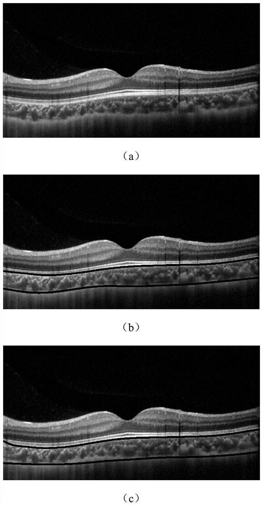 A method for automatic estimation of choroidal thickness