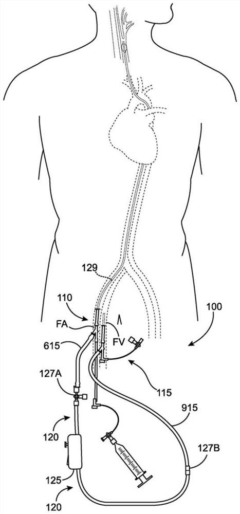 Methods and systems for establishing retrograde carotid blood flow