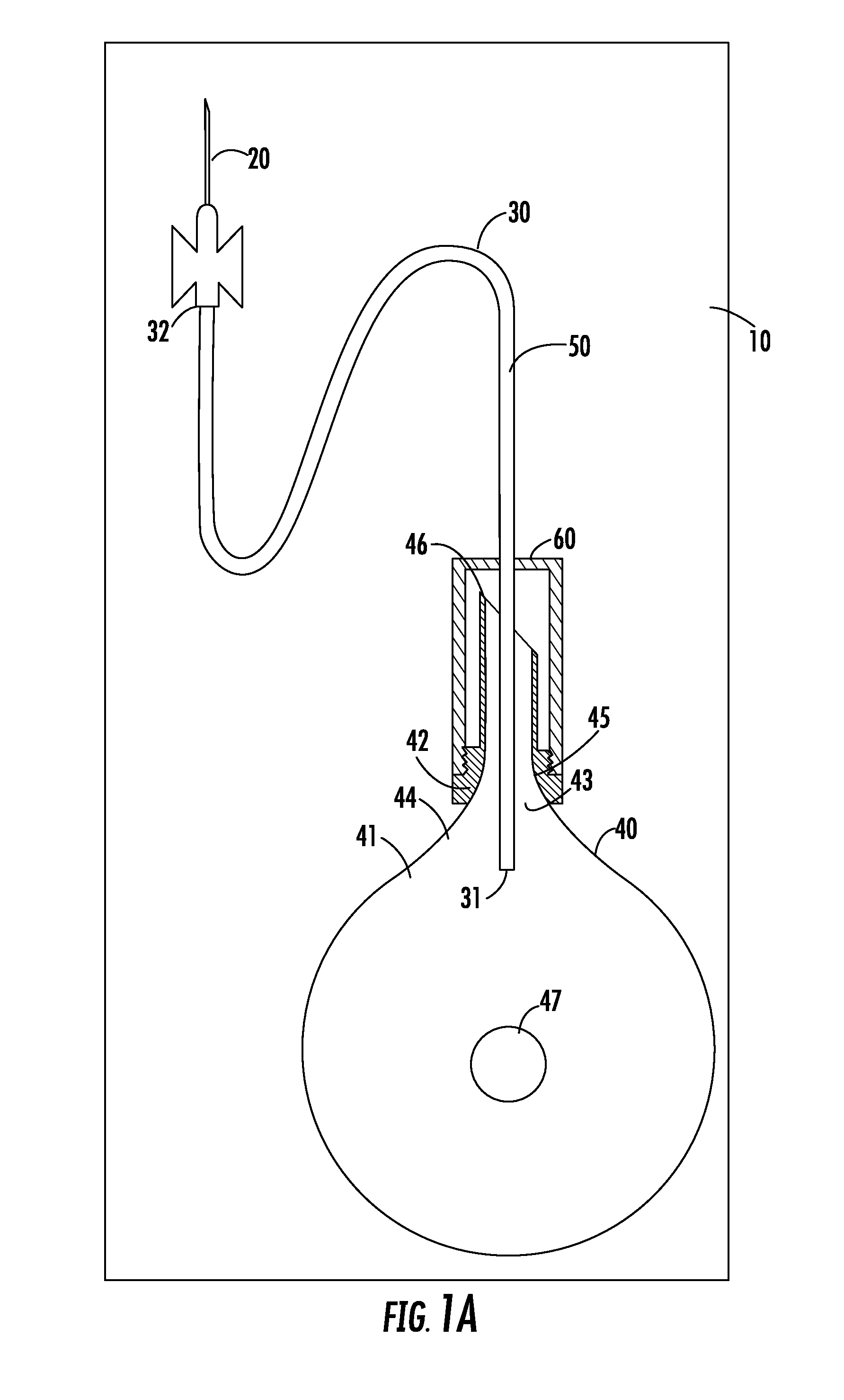 Apparatus and method for breast reconstruction and augmentation using an autologous platelet-rich fibrin matrix
